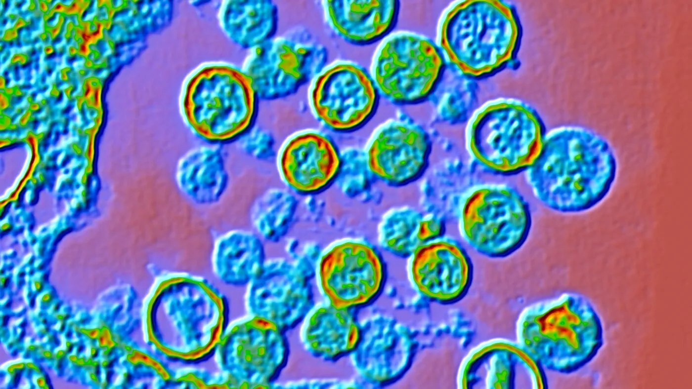 Hantavirus: următoarea pandemie sau o alarmă falsă? Analiza răspunsului autorităților și a riscurilor reale