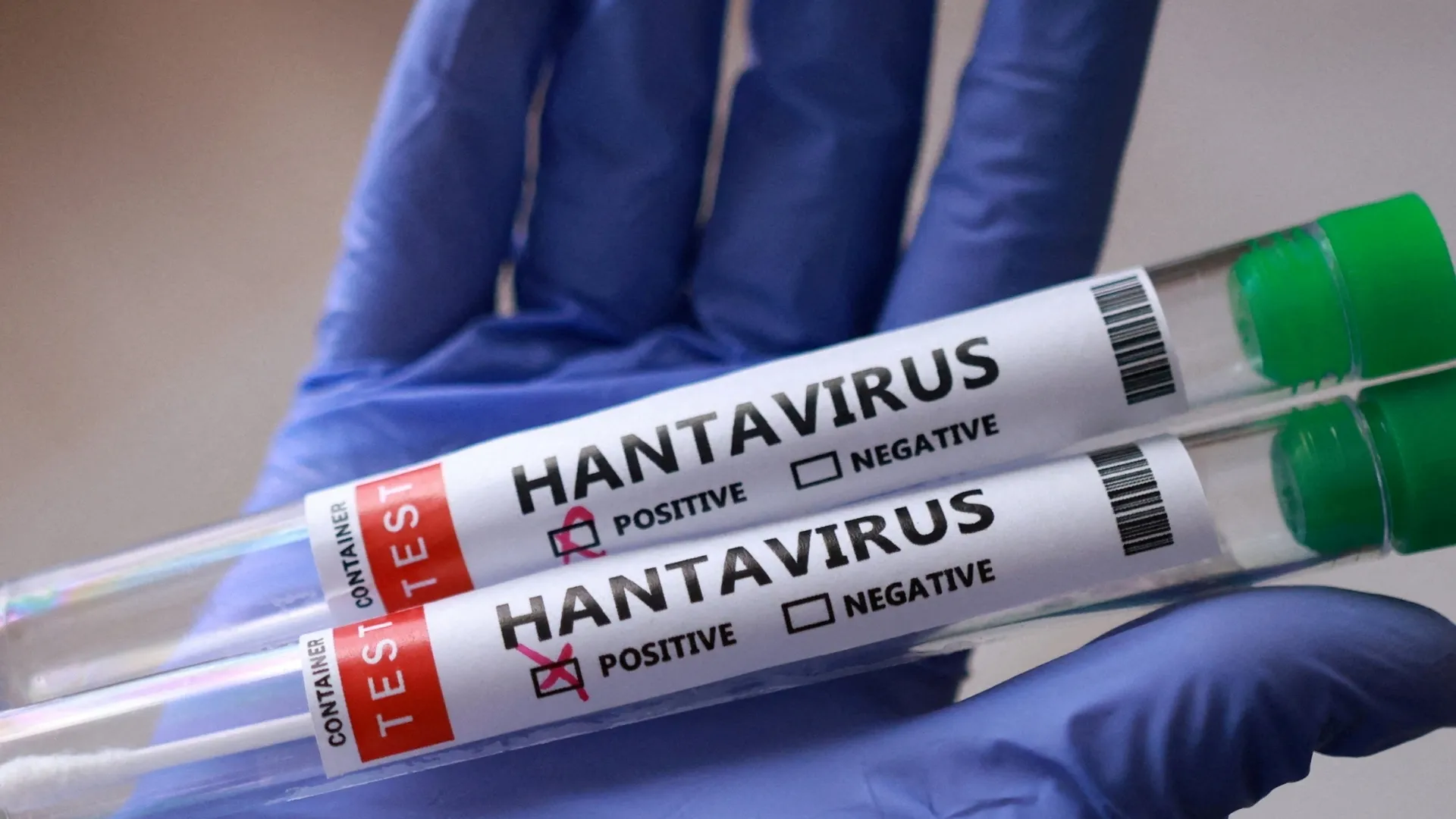 Ar trebui să ne îngrijoreze epidemia de hantavirus?