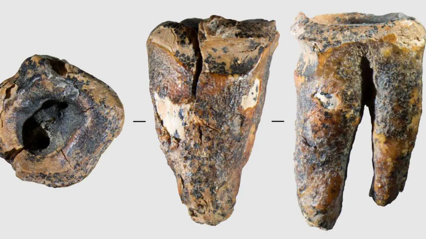 Neanderthalienii ar fi putut face un tratament de canal acum 59.000 de ani